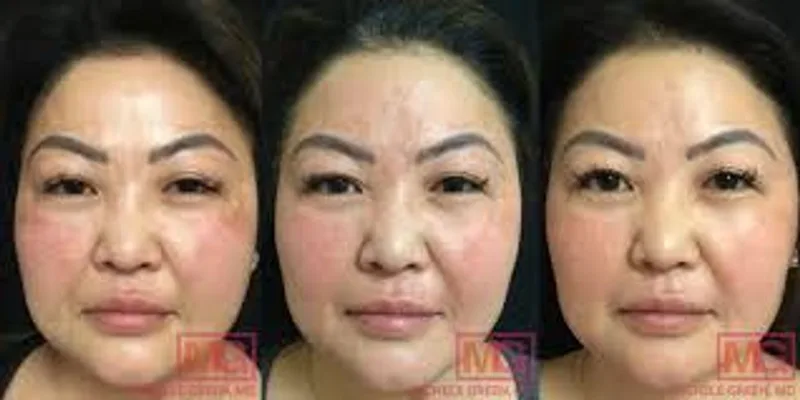 7 Day Melasma Relief Reset — 7 Day Melasma Relief Reset · screenshot 1 of 6
