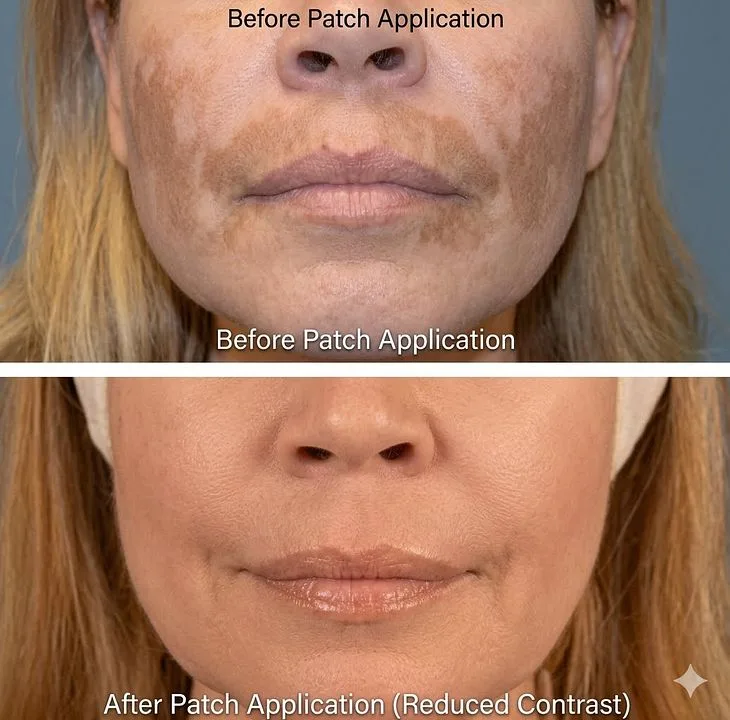 7 Day Melasma Relief Reset — 7 Day Melasma Relief Reset · screenshot 6 of 6